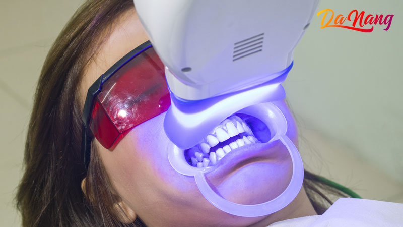 Nha-khoa-da-nang-implant-1-thanhphodanang